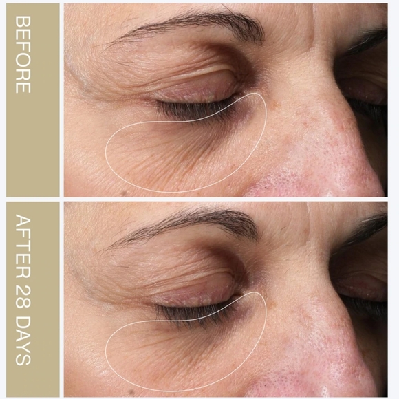 NEW Neolastin Revitalize & Firm Eye Cream - Picture 2 of 8